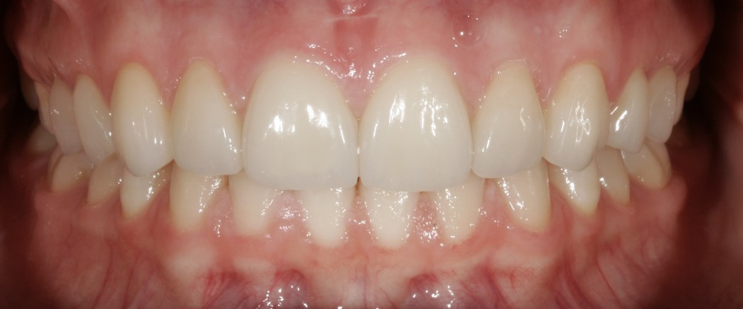 Intraoral_02