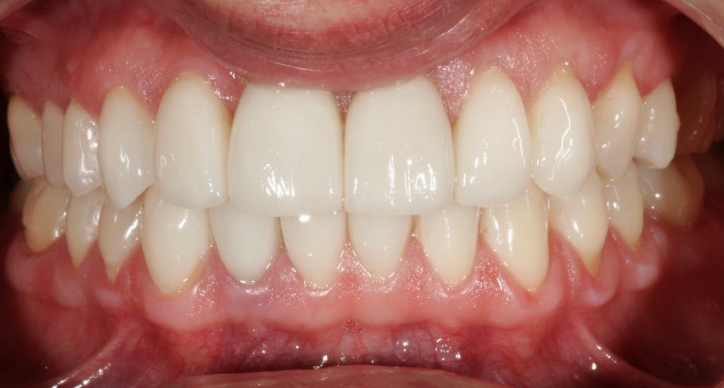 Intraoral_nachher_03