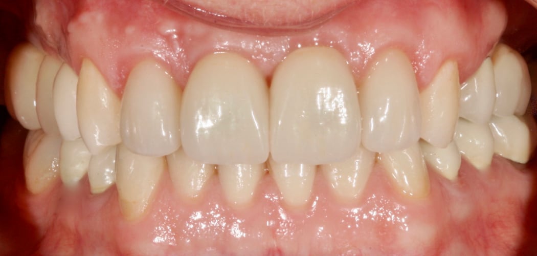 Intraoral_nachher_06