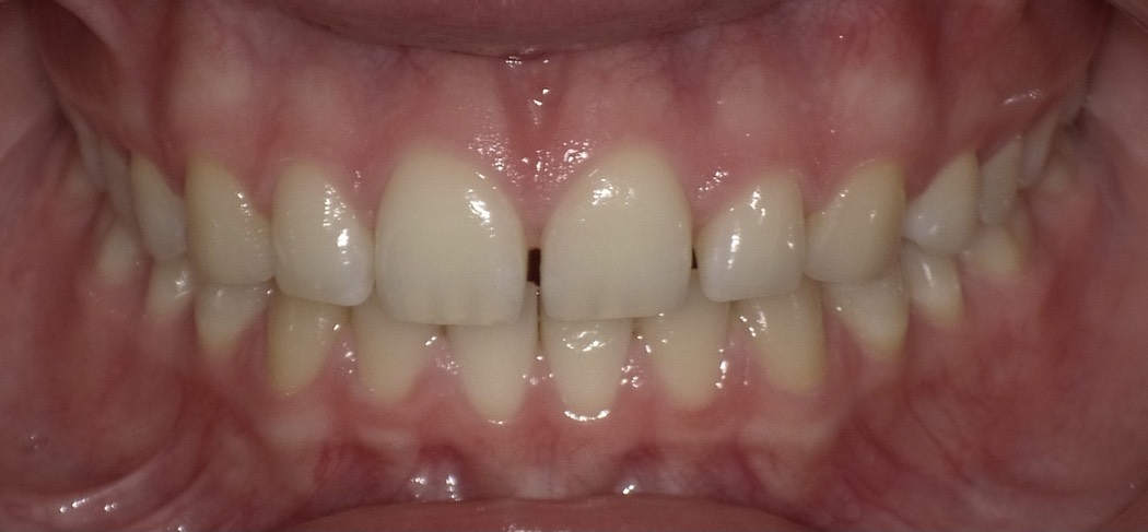 Intraoral_02